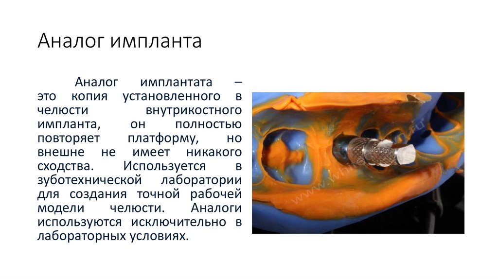 Аналог импланта