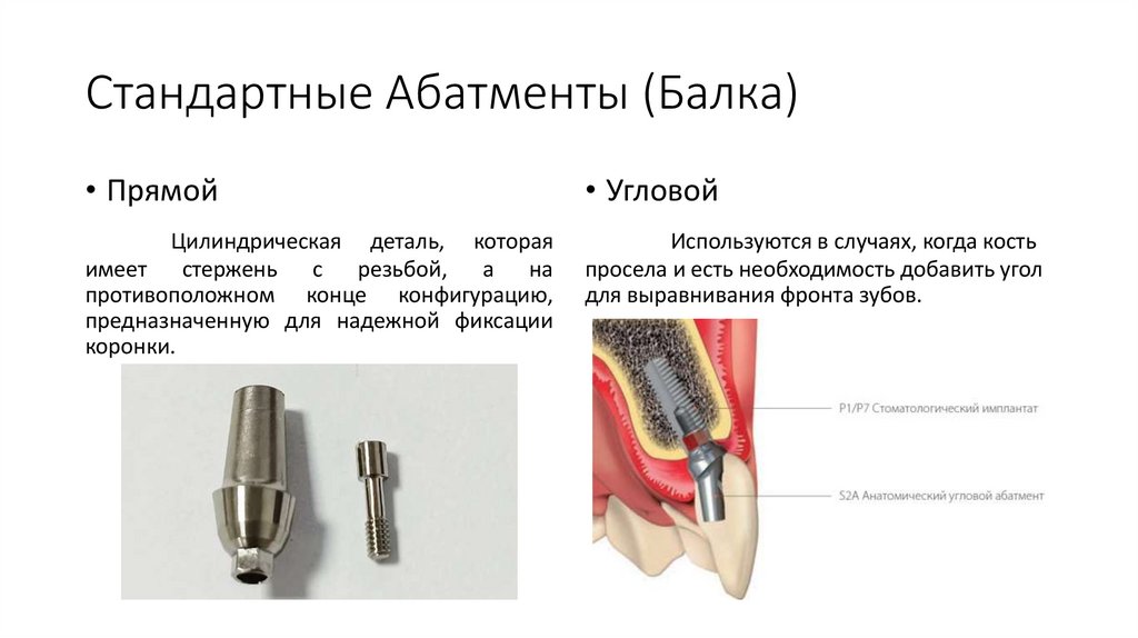 Стандартные Абатменты (Балка)