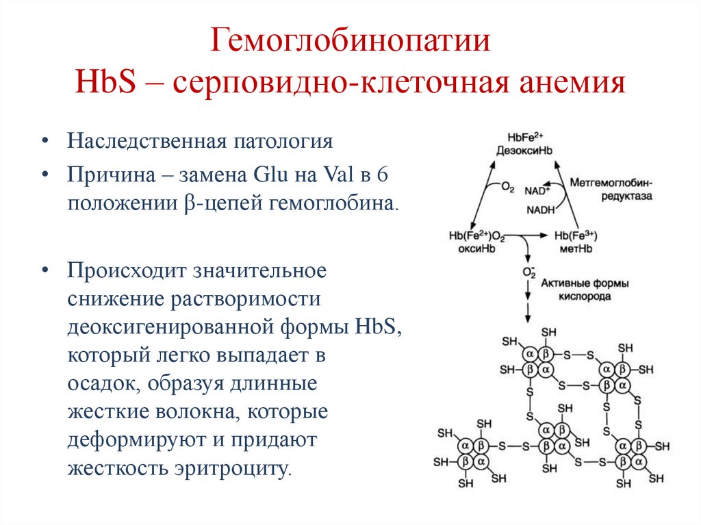 Гемоглобинопатии HbS – серповидно-клеточная анемия