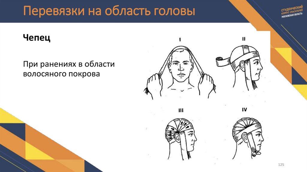 Перевязки на область головы