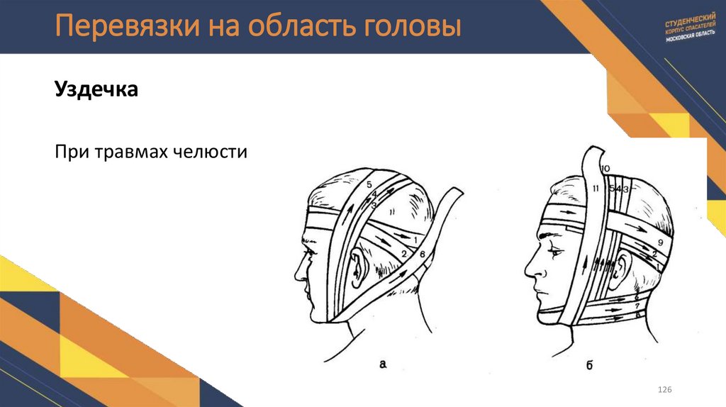 Перевязки на область головы