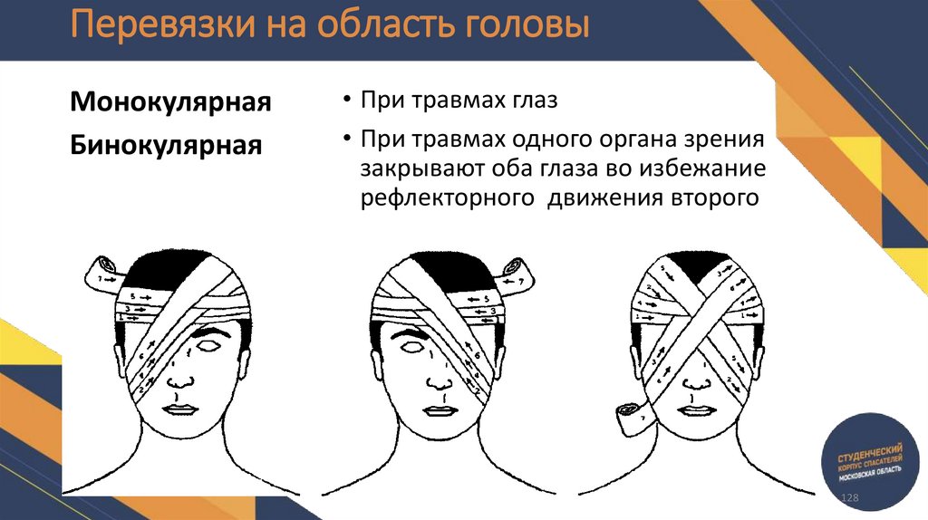 Перевязки на область головы