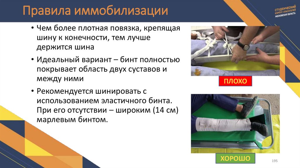 Правила иммобилизации