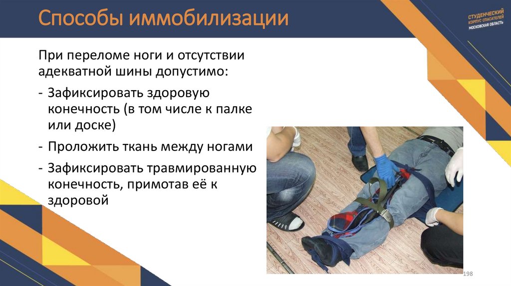 Способы иммобилизации