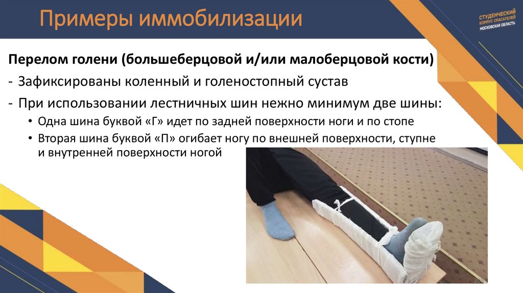 Примеры иммобилизации