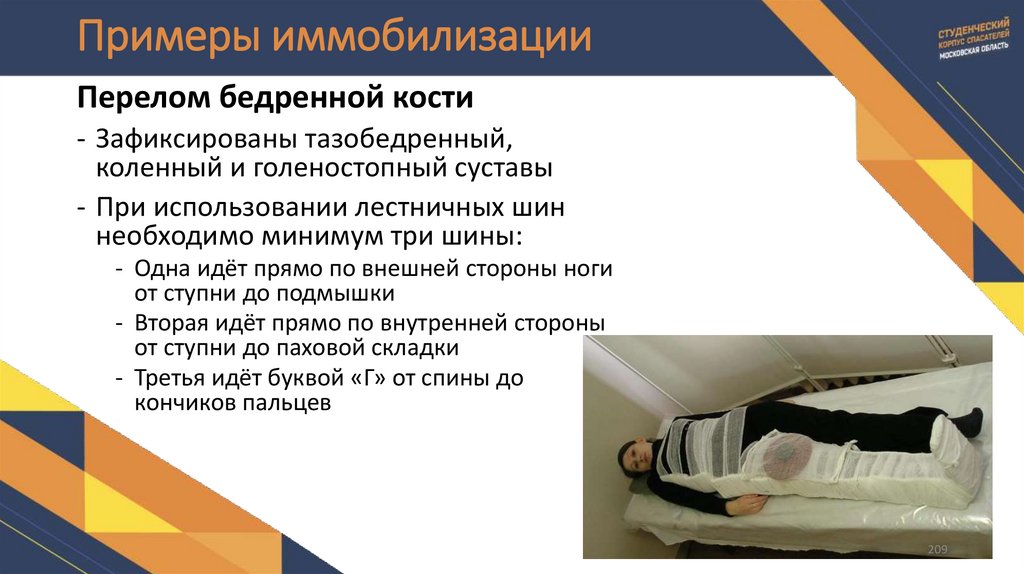 Примеры иммобилизации