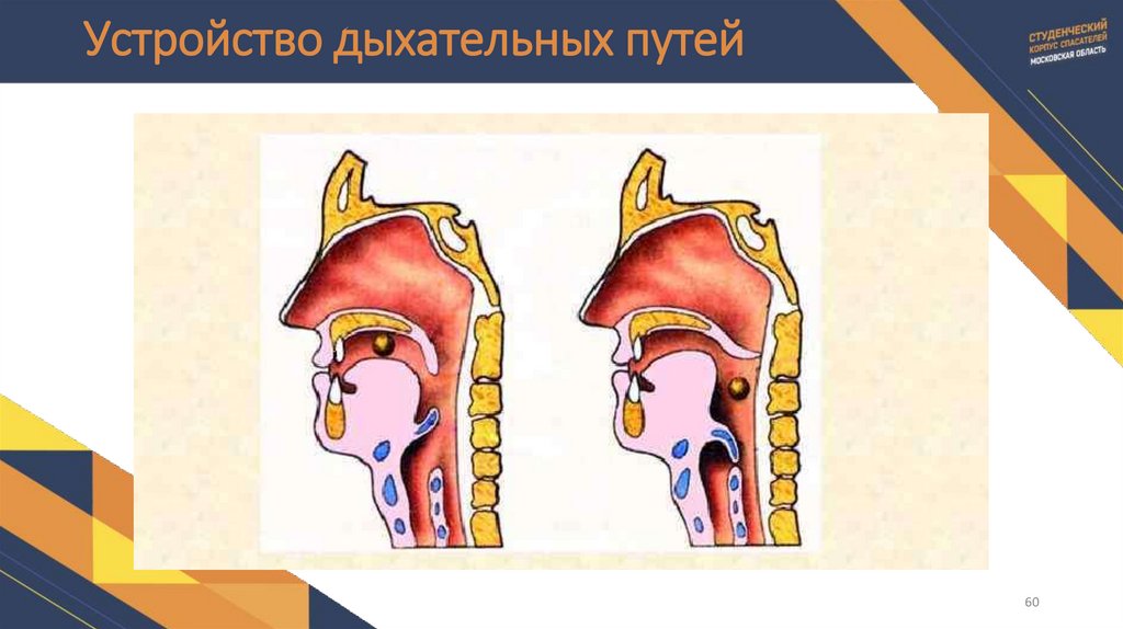 Устройство дыхательных путей