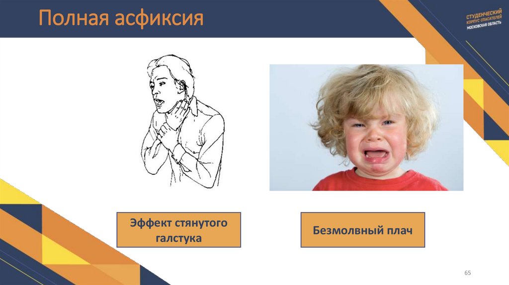 Полная асфиксия