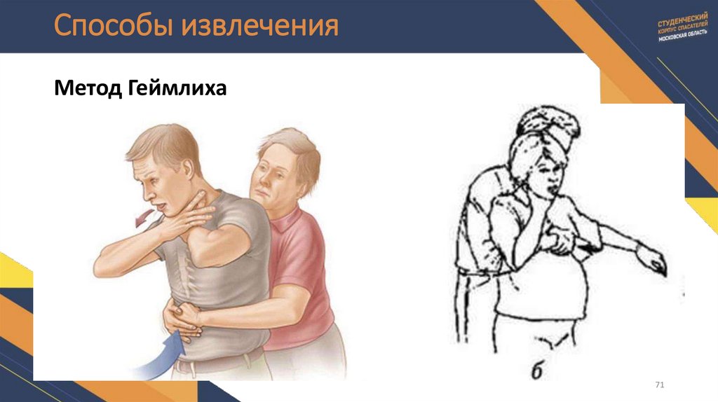 Способы извлечения