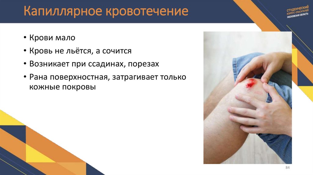 Капиллярное кровотечение