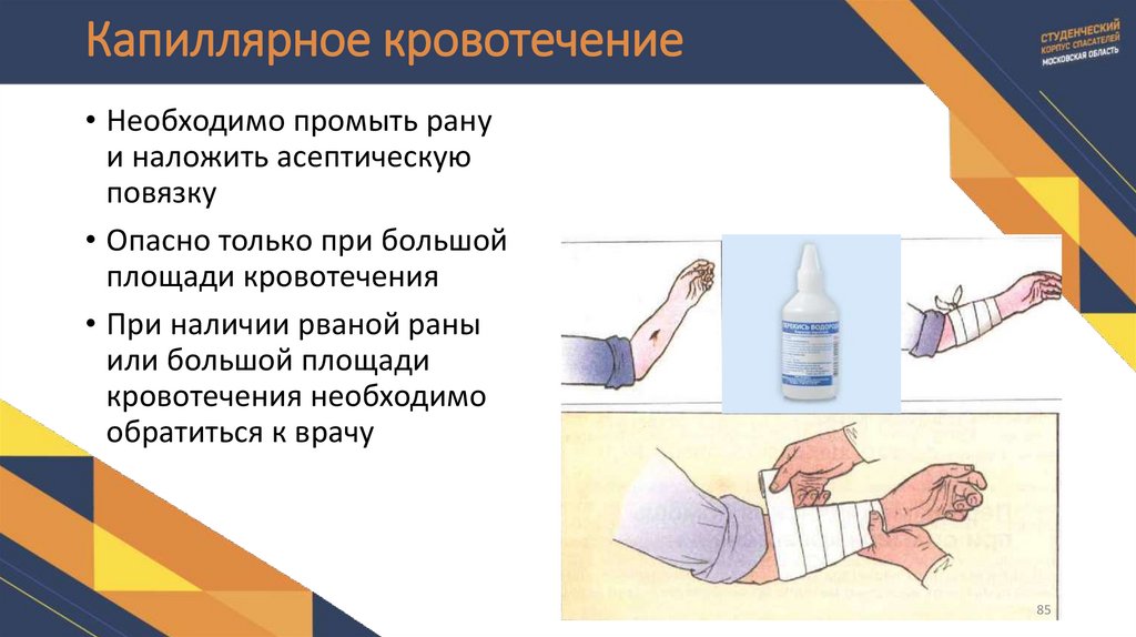 Капиллярное кровотечение