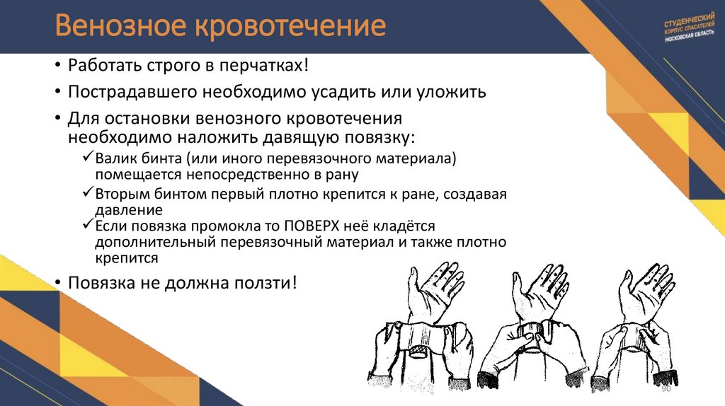 Венозное кровотечение