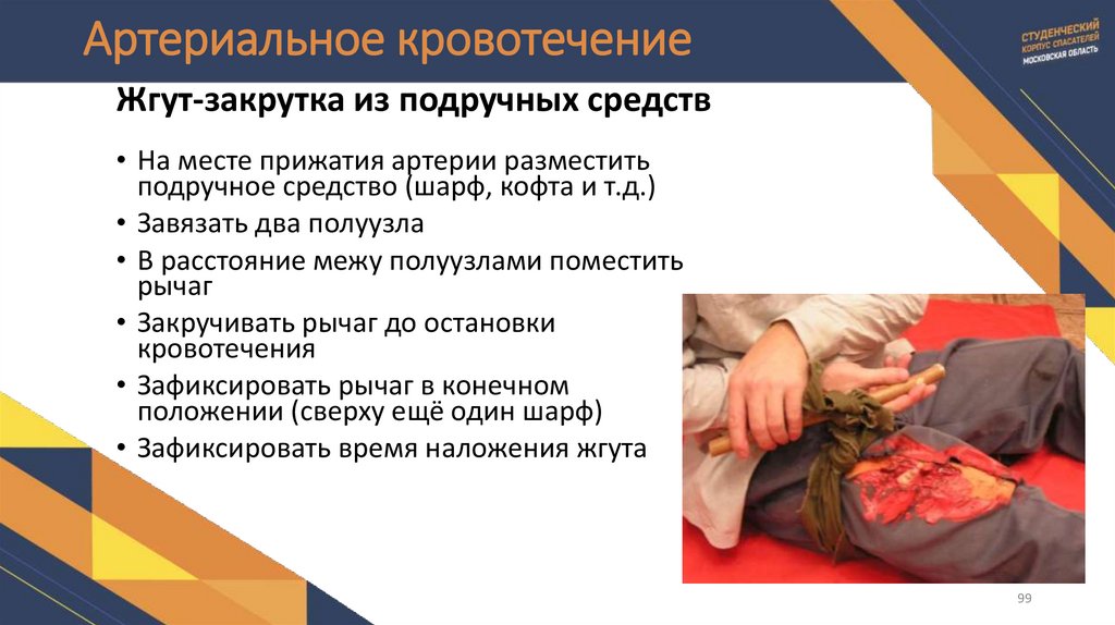 Артериальное кровотечение