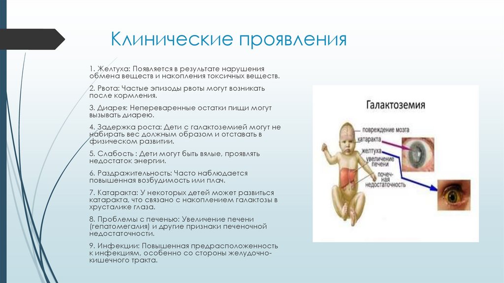 Клинические проявления