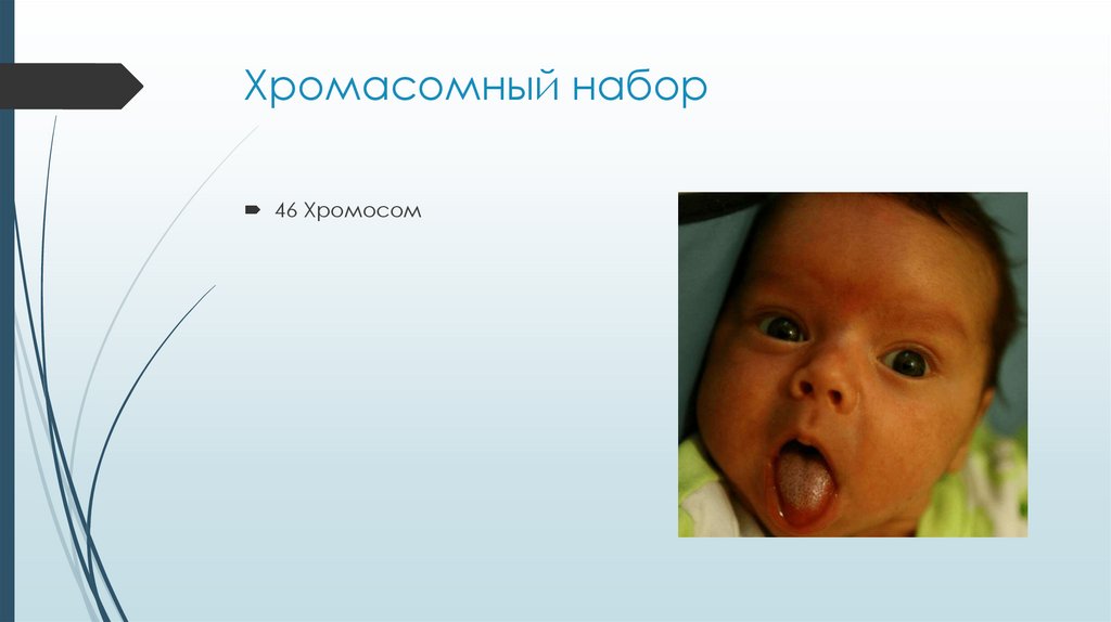 Хромасомный набор