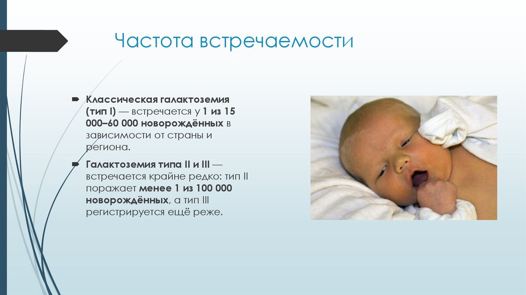 Частота встречаемости