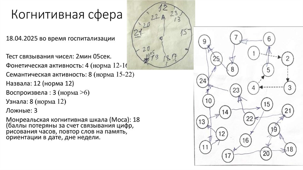 Когнитивная сфера