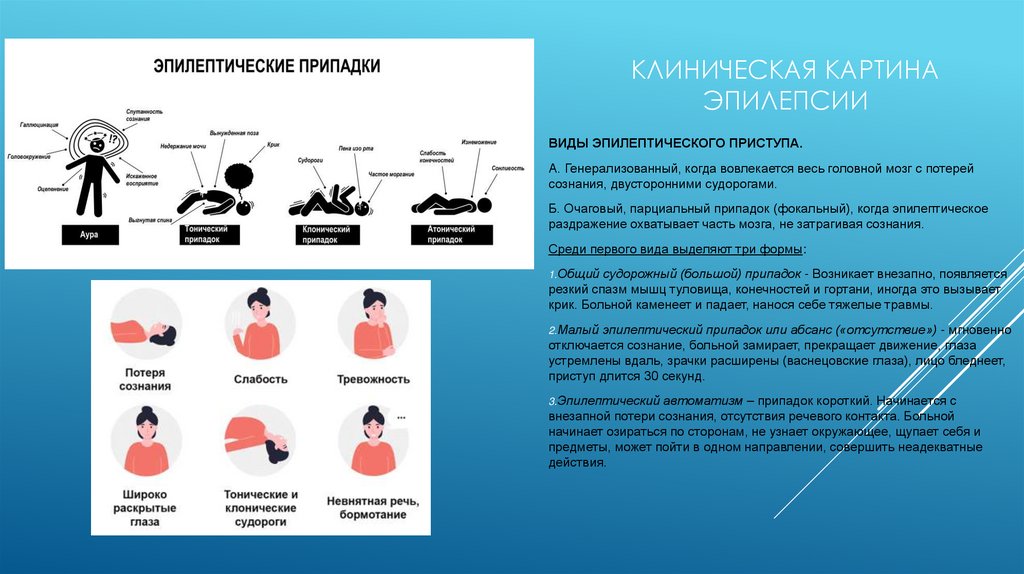Клиническая картина эпилепсии