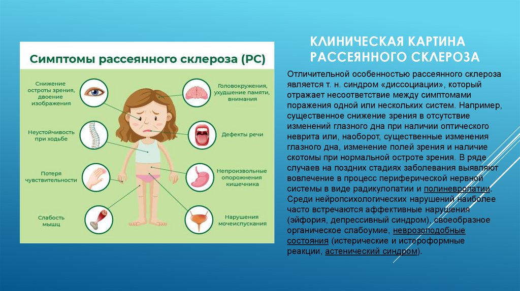 Клиническая картина рассеянного склероза