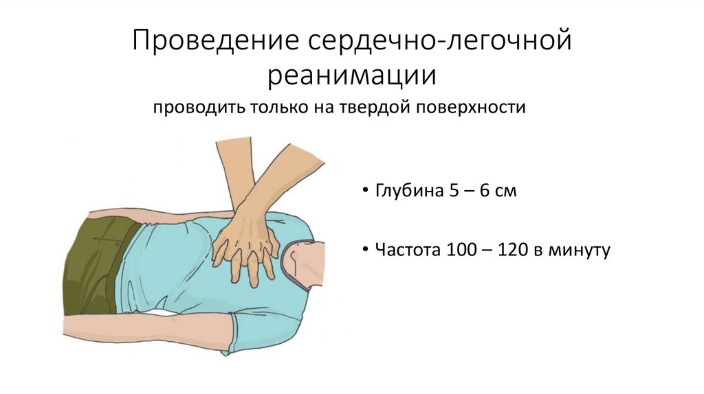 Проведение сердечно-легочной реанимации