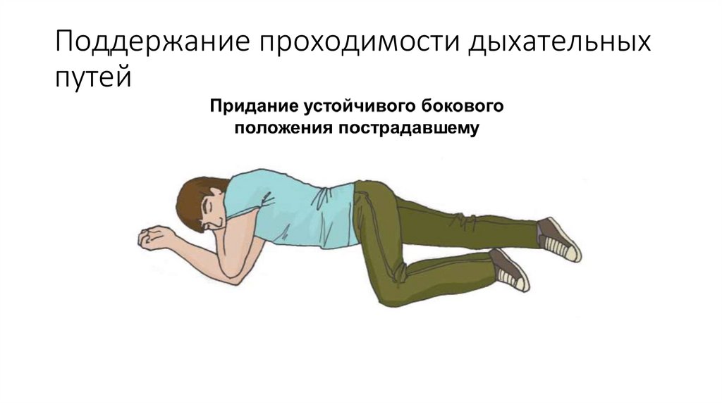 Поддержание проходимости дыхательных путей