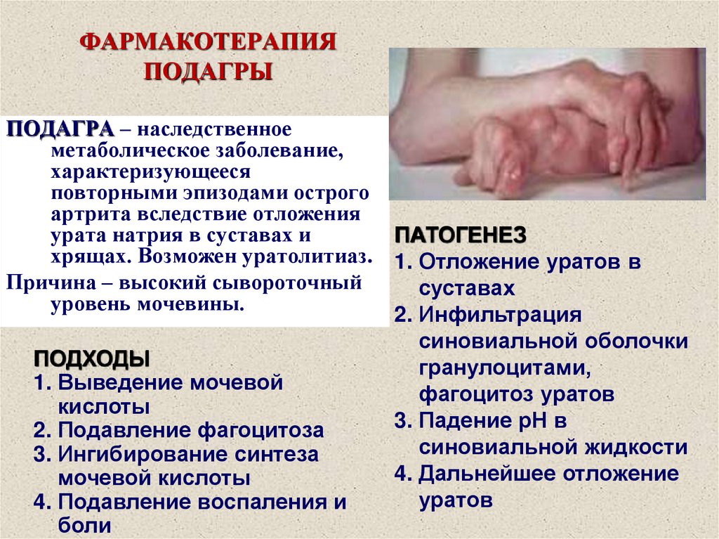 ФАРМАКОТЕРАПИЯ ПОДАГРЫ