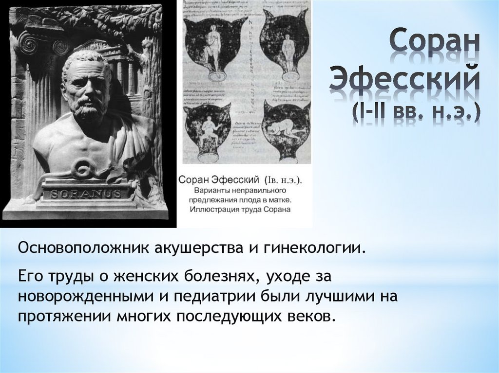 Соран Эфесский (I-II вв. н.э.)