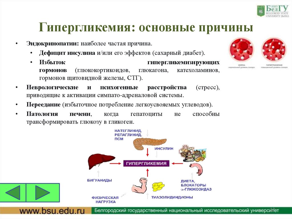 Гипергликемия: основные причины
