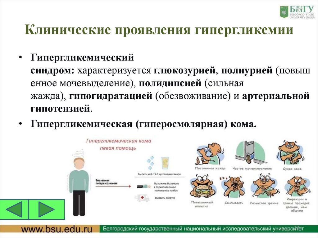 Клинические проявления гипергликемии