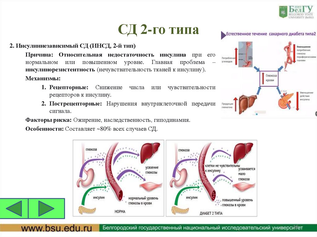 СД 2-го типа