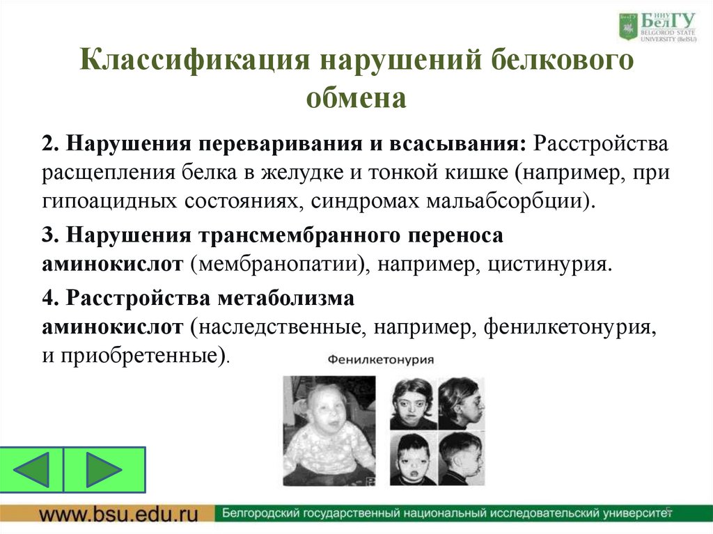 Классификация нарушений белкового обмена