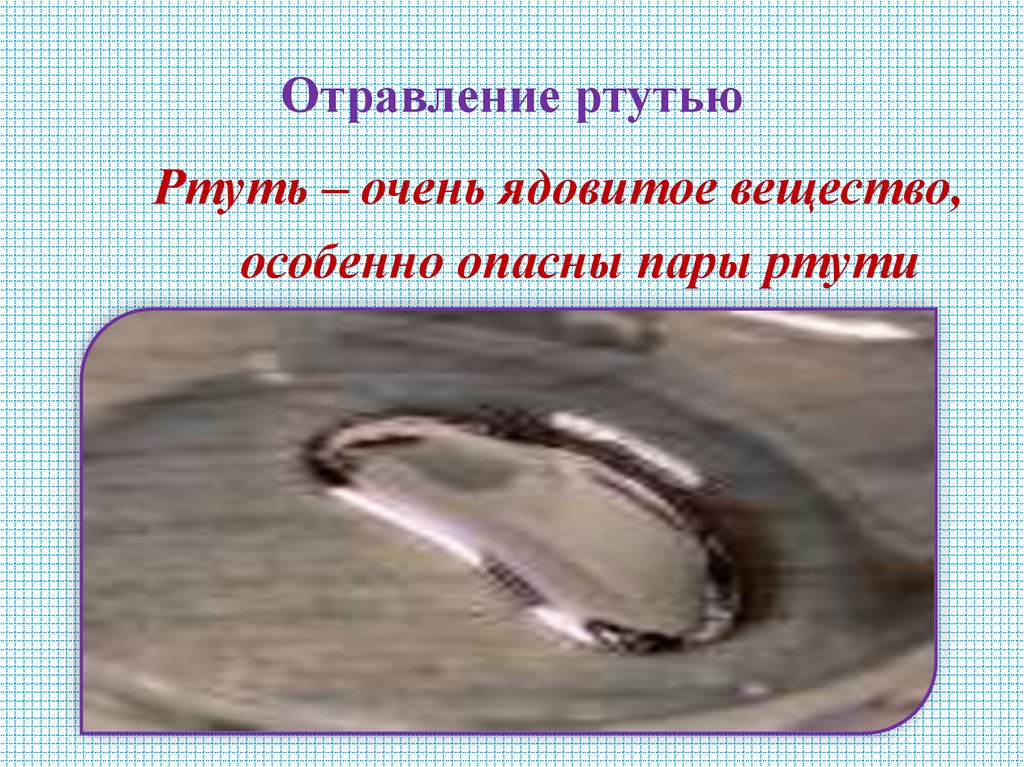 Отравление ртутью