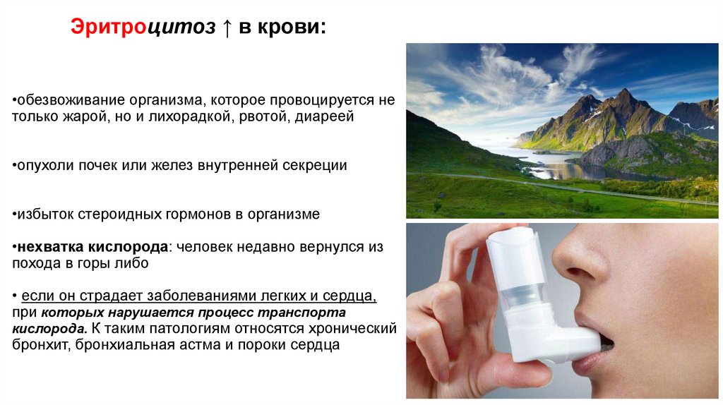 Эритроцитоз ↑ в крови: