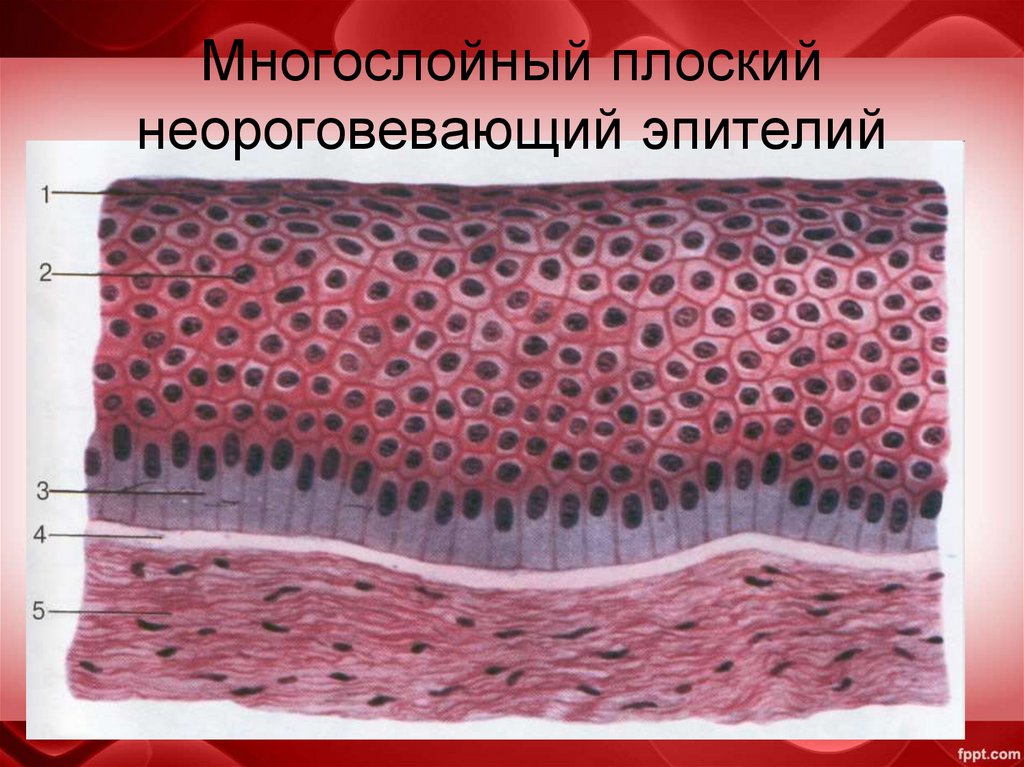 Многослойный плоский неороговевающий эпителий