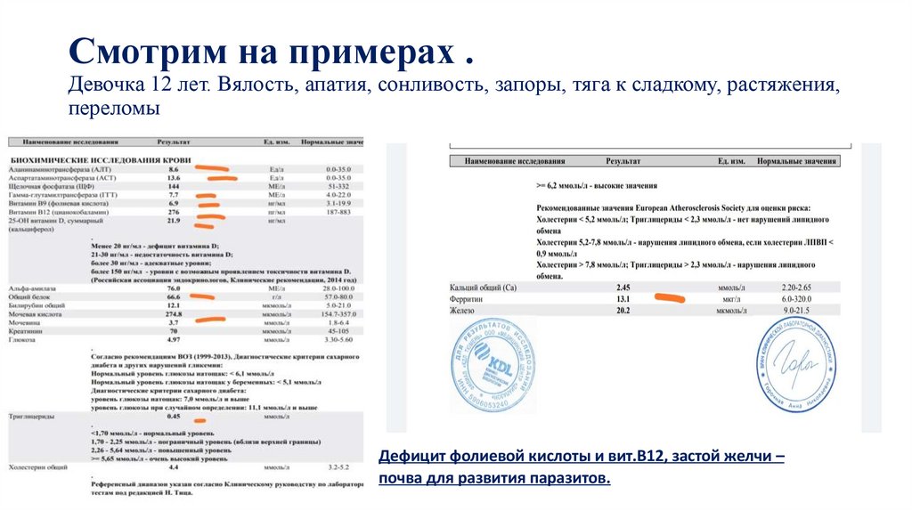 Смотрим на примерах . Девочка 12 лет. Вялость, апатия, сонливость, запоры, тяга к сладкому, растяжения, переломы