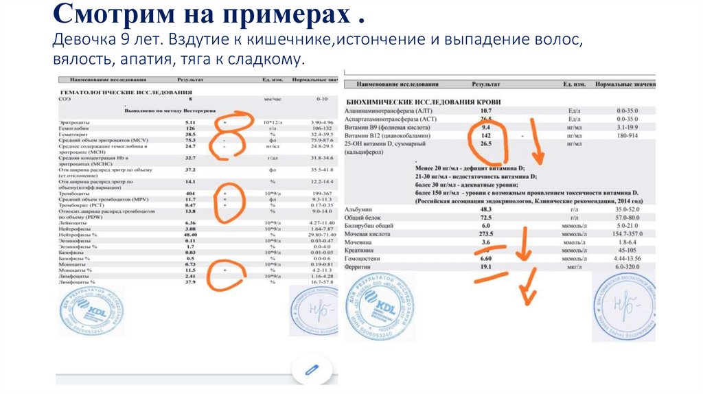 Смотрим на примерах . Девочка 9 лет. Вздутие к кишечнике,истончение и выпадение волос, вялость, апатия, тяга к сладкому.