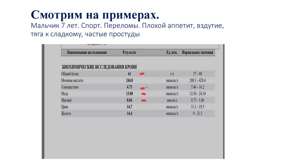 Смотрим на примерах. Мальчик 7 лет. Спорт. Переломы. Плохой аппетит, вздутие, тяга к сладкому, частые простуды