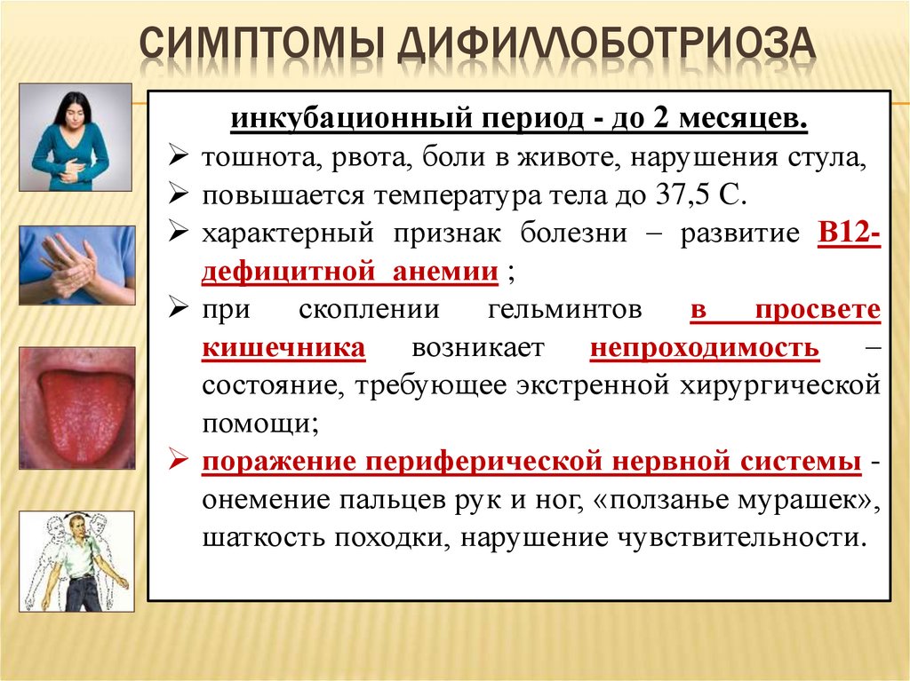 Симптомы дифиллоботриоза