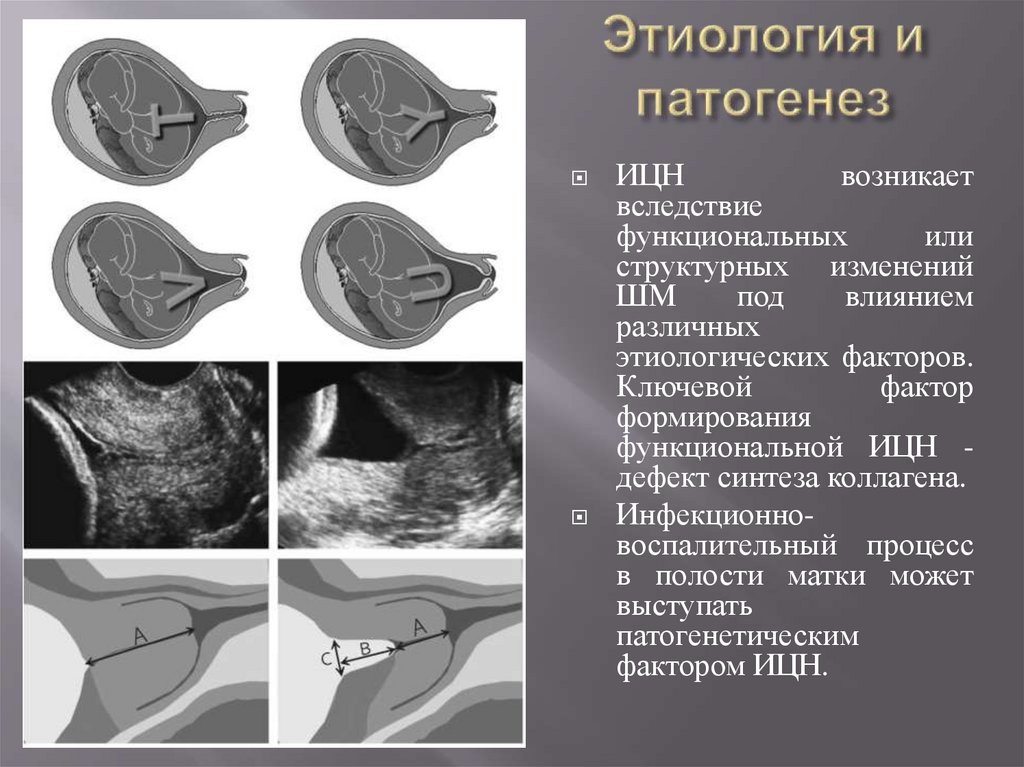 Этиология и патогенез
