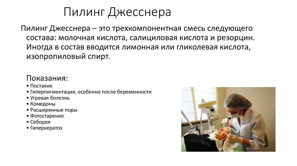 Пилинг Джесснера