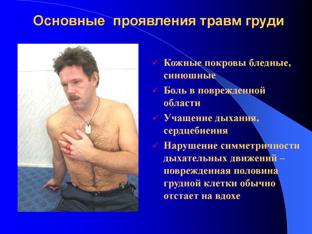 Основные проявления травм груди