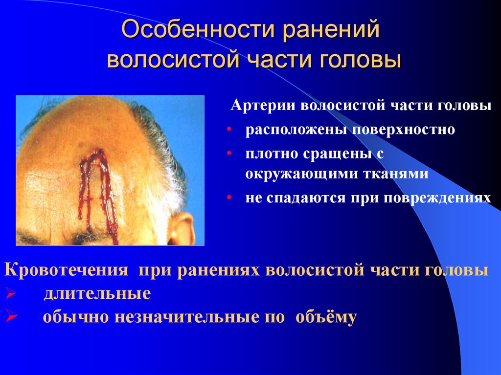 Особенности ранений волосистой части головы