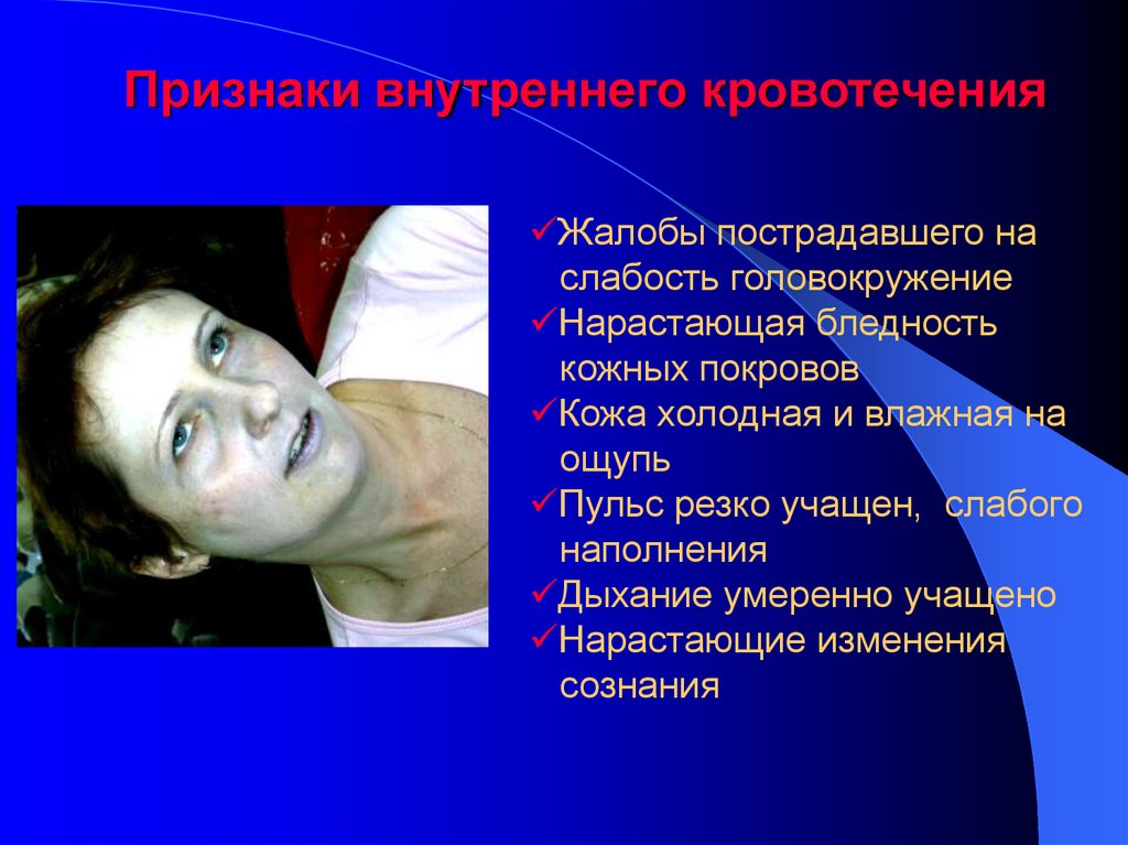 Признаки внутреннего кровотечения
