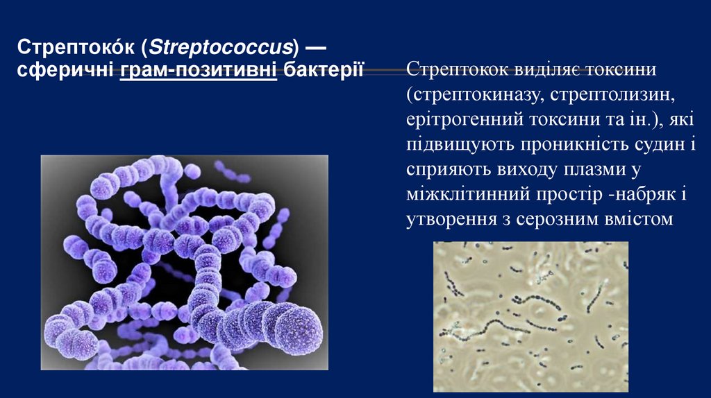 Стрептоко́к (Streptococcus) — сферичні грам-позитивні бактерії