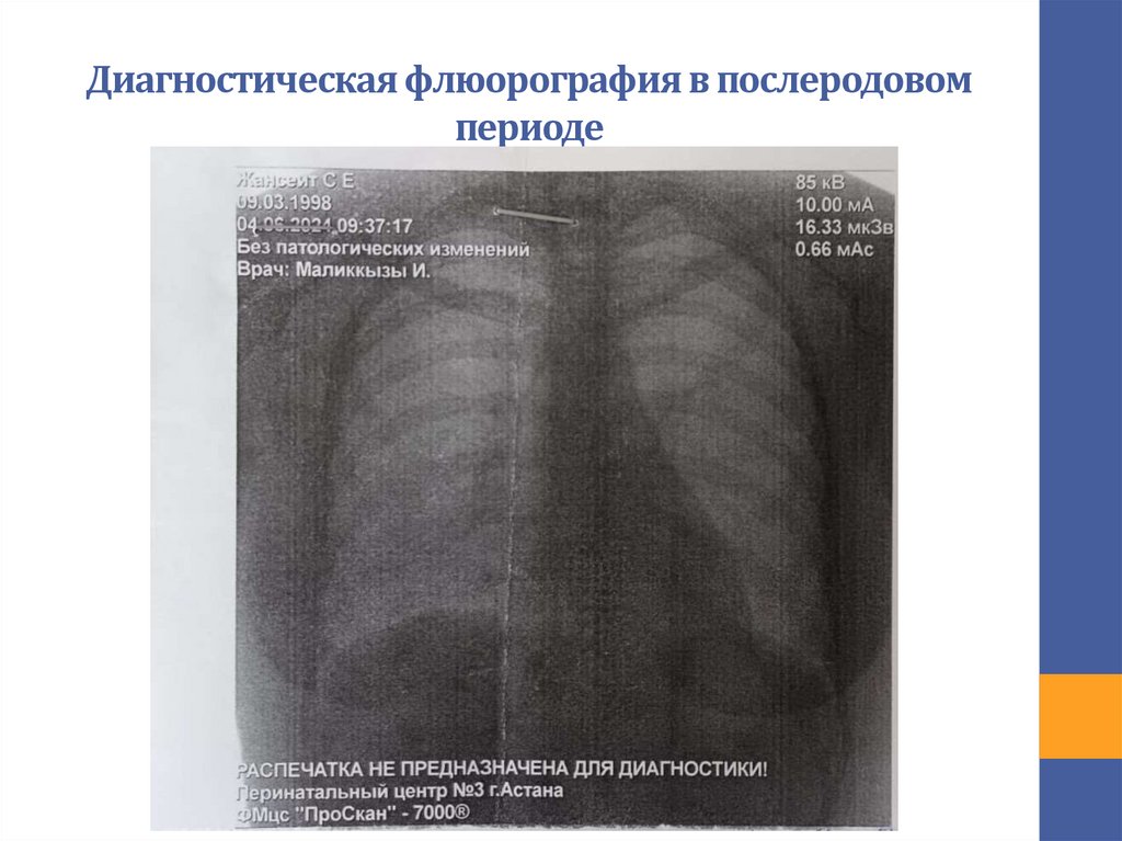 Диагностическая флюорография в послеродовом периоде