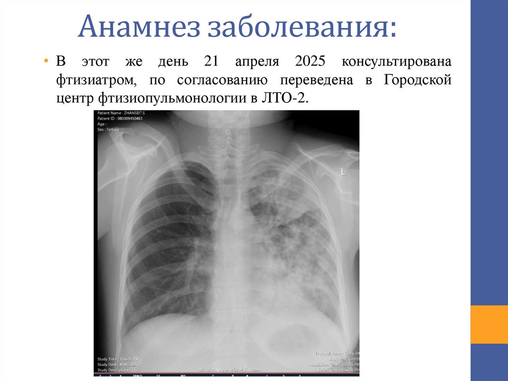 Анамнез заболевания: