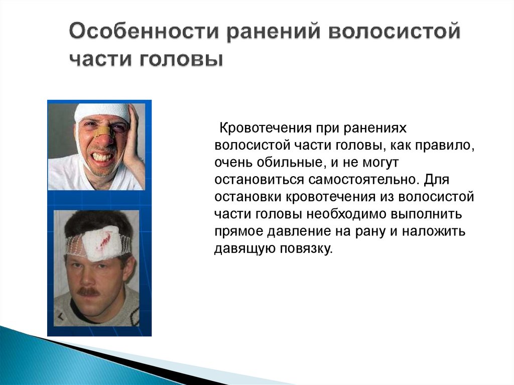 Особенности ранений волосистой части головы