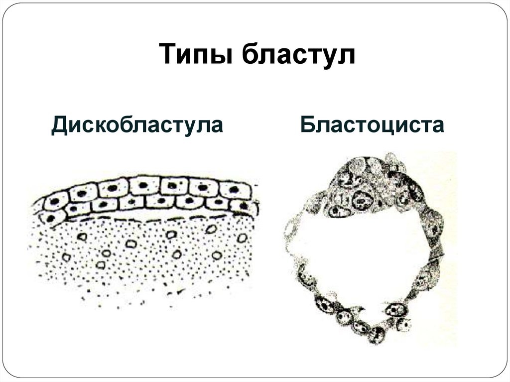 Типы бластул