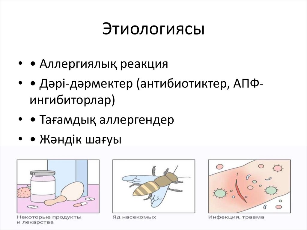 Этиологиясы