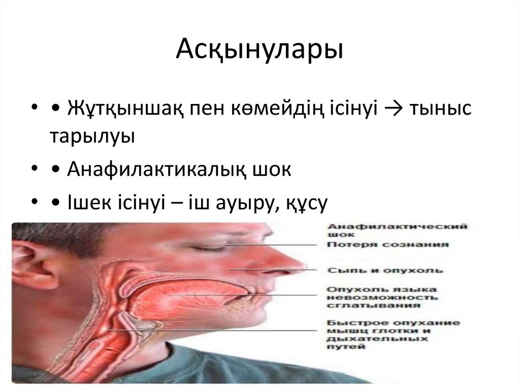 Асқынулары